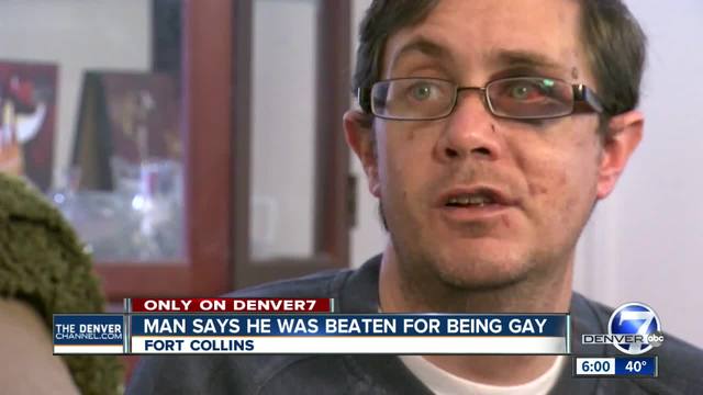 Free transsexual pictures Gay man beaten
